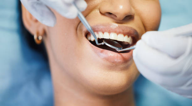 Best Emergency Broken Tooth Repair in Dayton, OH